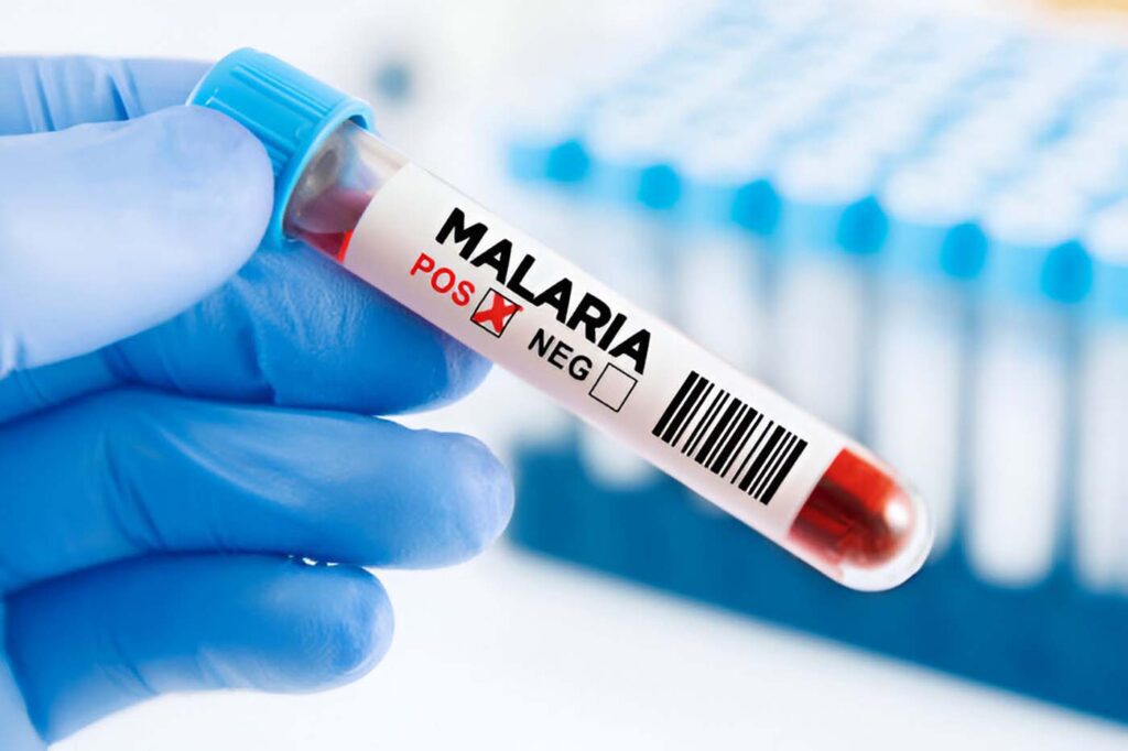 CHAN 2024 Health & Safety Guide: Your Complete Survival Kit for East Africa's Football Festival 2 Malaria diagnosis